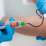 Exame de sangue para diagnóstico de câncer de mama preocupa sociedades médicas