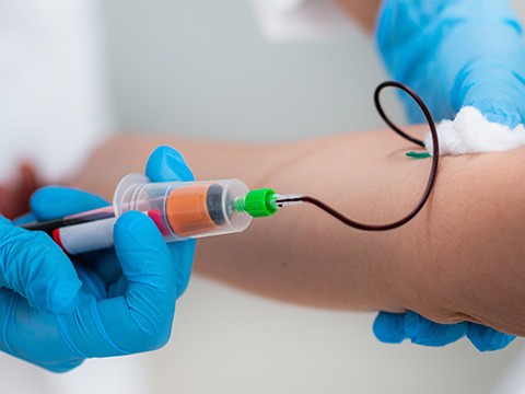 Exame de sangue para diagnóstico de câncer de mama preocupa sociedades médicas