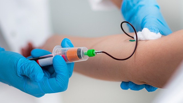 Exame de sangue para diagnóstico de câncer de mama preocupa sociedades médicas