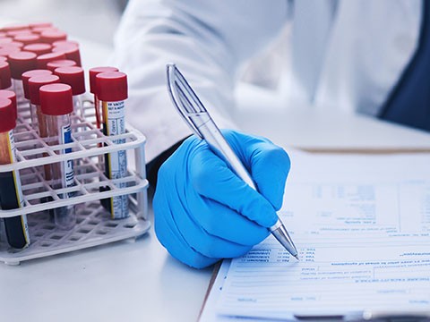 Exame Anatomopatológico no Câncer de Mama: O Que É e Para Que Serve
