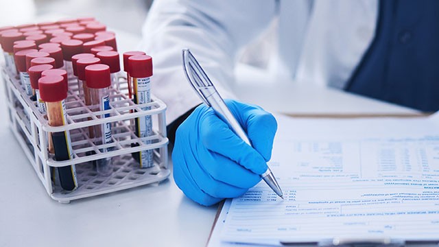 Exame Anatomopatológico no Câncer de Mama: O Que É e Para Que Serve