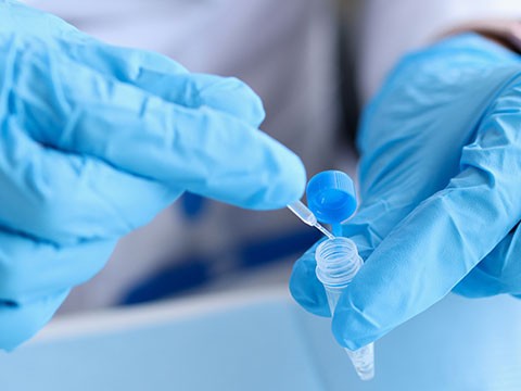 Core biopsy mamária: quando a biópsia da mama é necessária?