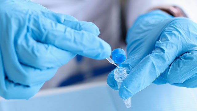 Core biopsy mamária: quando a biópsia da mama é necessária?