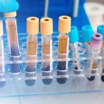 O Que é a Imunohistoquímica no Câncer de Mama?
