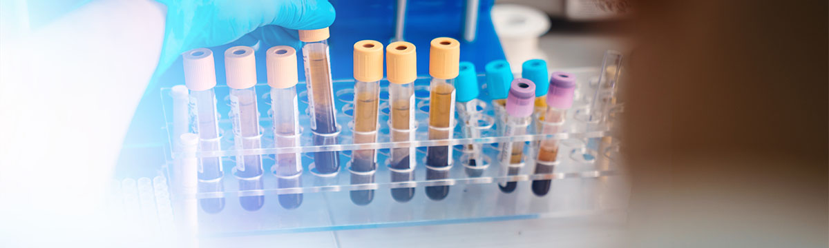 O Que é a Imunohistoquímica no Câncer de Mama?